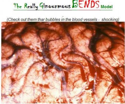 bubble-brain[1].jpg
